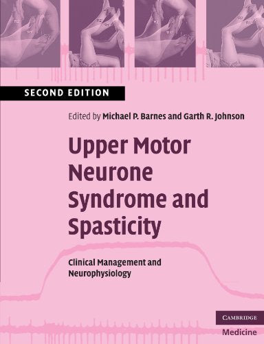 Upper Motor Neurone Syndrome and Spasticity