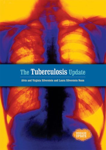 The Tuberculosis Update