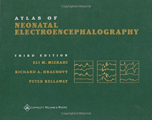 Atlas of Neonatal Electroencephalography cover