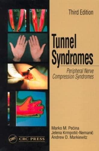 Tunnel Syndromes cover
