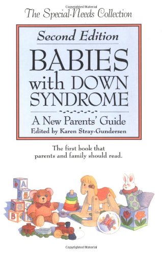Babies with Down Syndrome