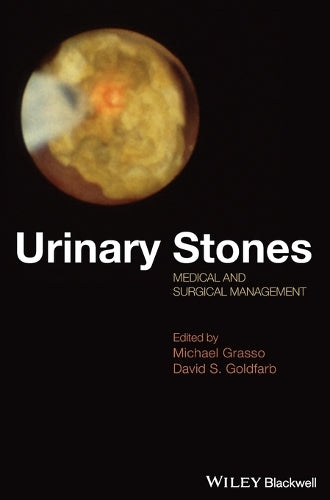 Urinary Stones cover