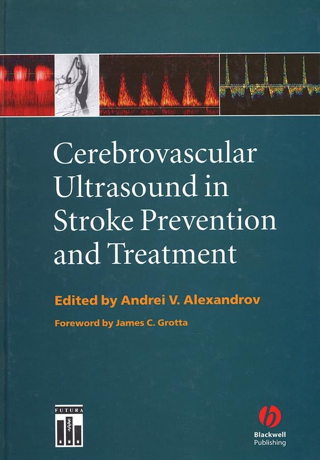 Cerebrovascular Ultrasound in Stroke Prevention and Treatment cover