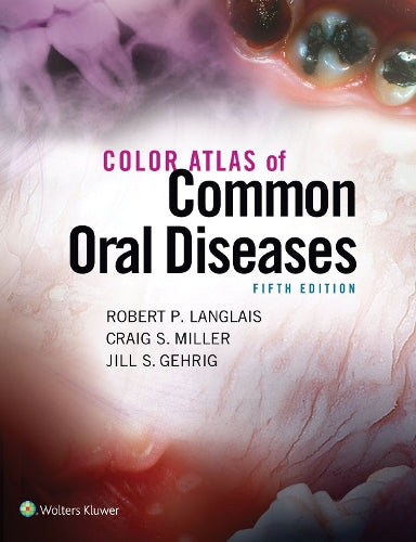 Color Atlas of Common Oral Diseases