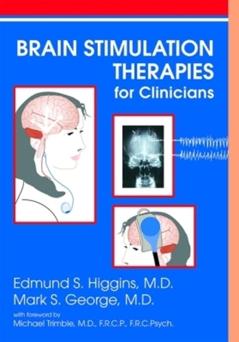 Brain Stimulation Therapies for Clinicians