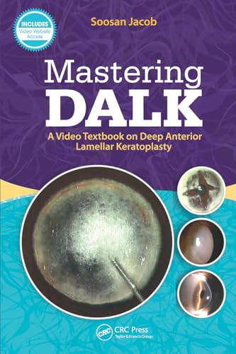 Mastering DALK