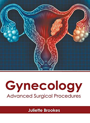 Gynecology: Advanced Surgical Procedures