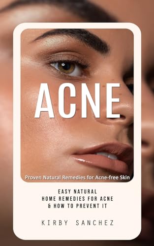 Acne