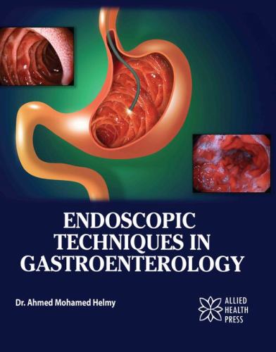 Endoscopic Techniques in Gastroenterology cover