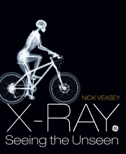 X-Ray