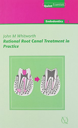 Rational Root Canal Treatment in Practice