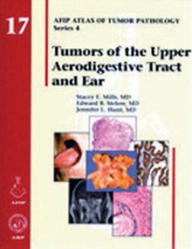 Tumors of the Upper Aerodigestive Tract and Ear