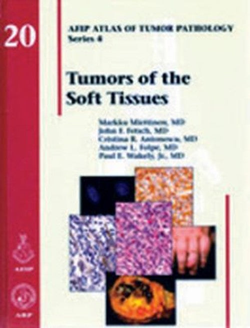 Tumors of the Soft Tissues