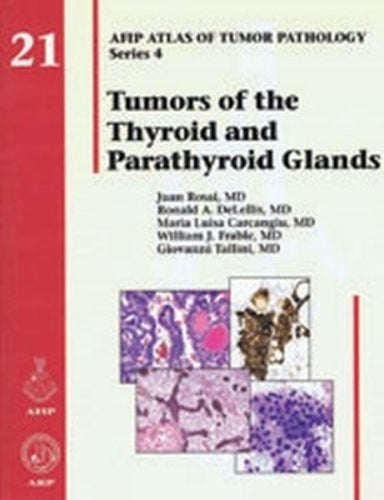 Tumors of the Thyroid and Parathyroid Glands cover art