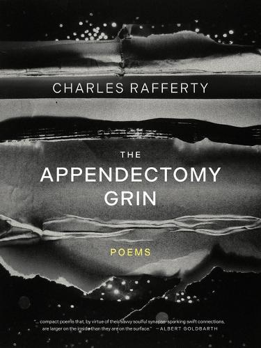 The Appendectomy Grin