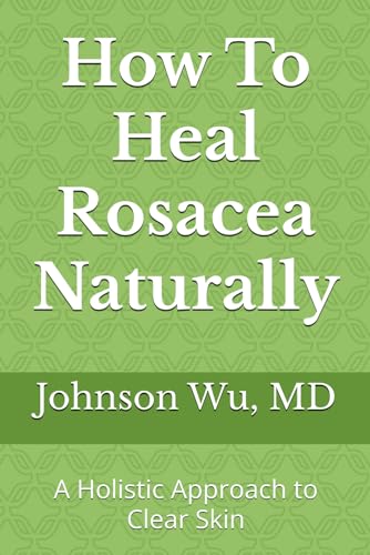 How To Heal Rosacea Naturally: A Holistic Approach to Clear Skin