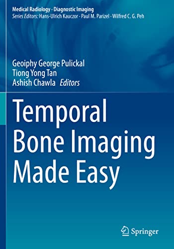 Temporal Bone Imaging Made Easy