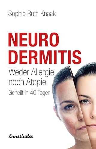 Neurodermitis.