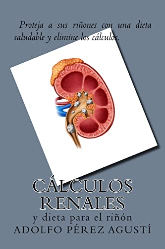 Calculos renales