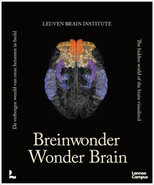 Wonder Brain
