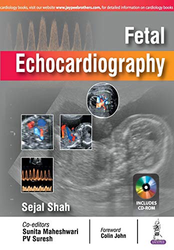 Fetal Echocardiography