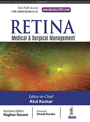 Retina