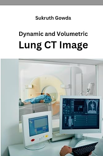 Dynamic and Volumetric Lung CT Image By Sukruth Gowda | World of Books US