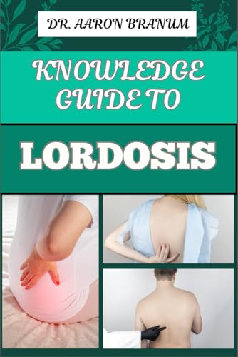 Knowledge Guide to Lordosis