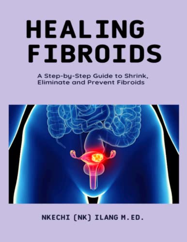 Healing Fibroids: A Step-By-Step Guide To Shrink, Eliminate and Prevent Fibroids