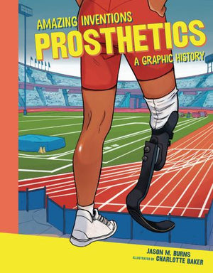 Prosthetics