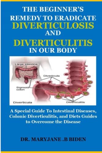THE BEGINNER’S REMEDY TO ERADICATE DIVERTICULOSIS AND DIVERTICULITIS IN OUR BODY: A Special Guide To Intestinal Diseases, Colonic Diverticulitis, and Diets Guides to Overcome the Disease