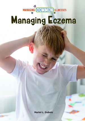 Managing Eczema