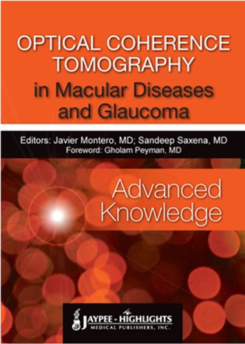 Optical Coherence Tomography in Macular Diseases and Glaucoma: Advanced Knowledge