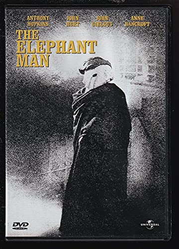 The Elephant Man