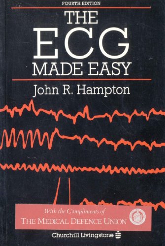 The ECG Made Easy