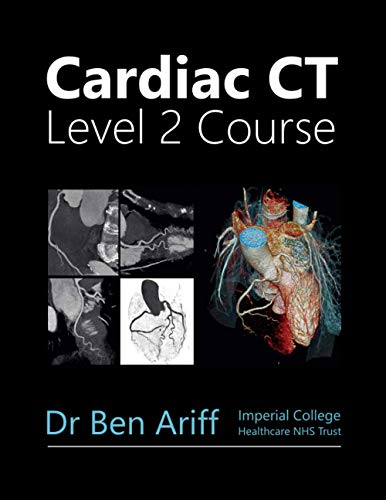 Cardiac CT: Imperial Lead Provider Level 2 Cardiac CT Coursebook