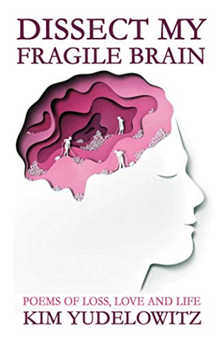 Dissect My Fragile Brain: Poems of Loss, Love and Life