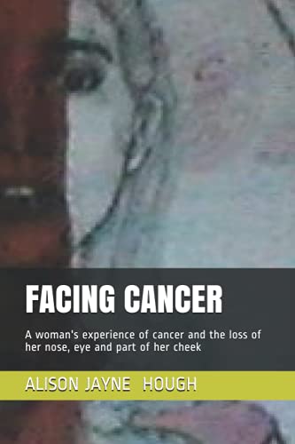 FACING CANCER: A woman's experience of cancer and the loss of her nose, eye and part of her cheek