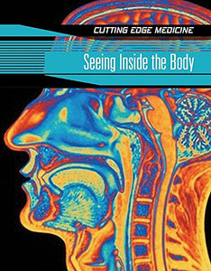 Seeing Inside The Body 