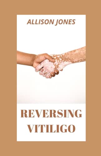 REVERSING VITILIGO: Hеаlthу And Dеlісіоuѕ Rесіреѕ Tо Nаturаllу Curе Vіtіlіgо, Enjоу Smооth Skіn: Fighting Vіtіlіgо Wіth Dіеt ALLISON