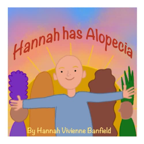 Hannah has Alopecia